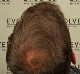 Evolved hair result