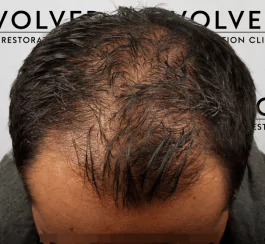 Evolved hair result